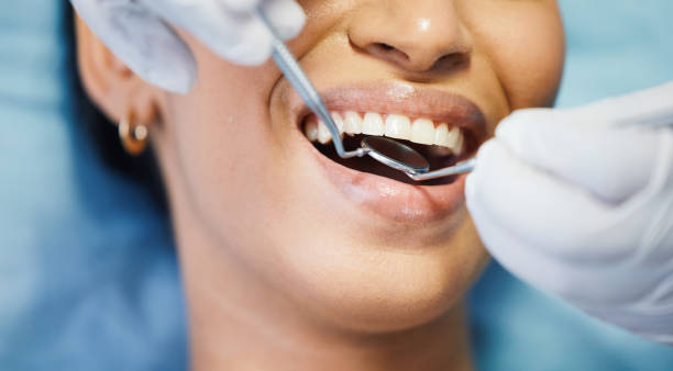Best Emergency Root Canal Treatment in Lake Jackson, TX